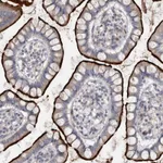 Atlas Antibodies Anti-OPLAH Antibody