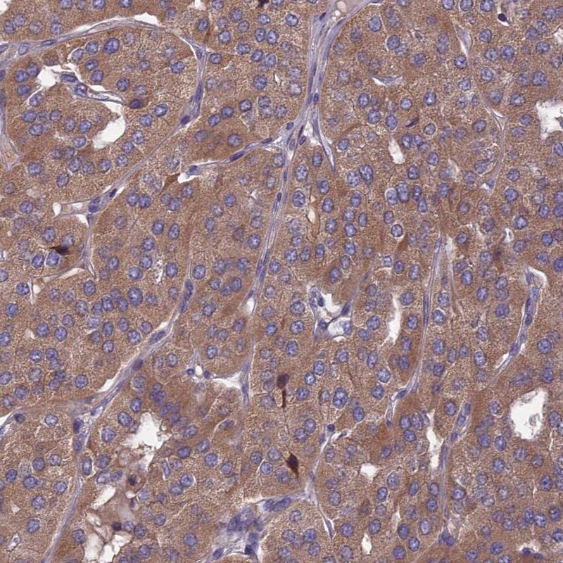 Atlas Antibodies Anti-OPA3 Antibody