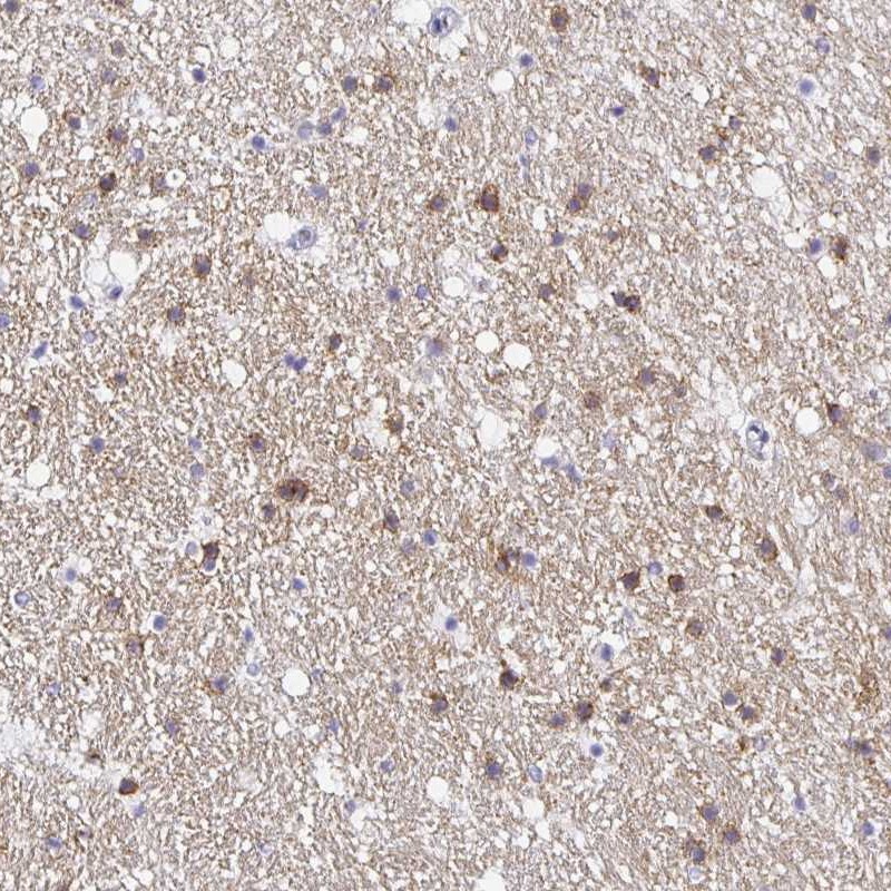 Atlas Antibodies Anti-OPALIN Antibody