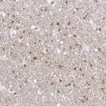 Atlas Antibodies Anti-OPALIN Antibody