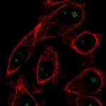 Atlas Antibodies Anti-OPLAH Antibody