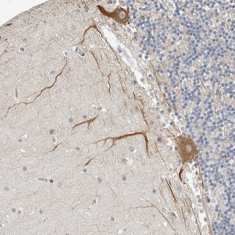 Atlas Antibodies Anti-OPLAH Antibody