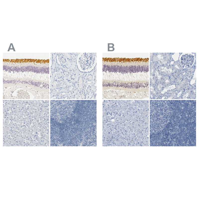 Atlas Antibodies Anti-OPN1SW Antibody