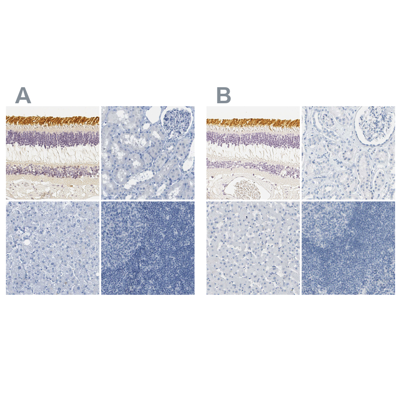 Atlas Antibodies Anti-OPN1SW Antibody