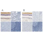 Atlas Antibodies Anti-OPN1SW Antibody