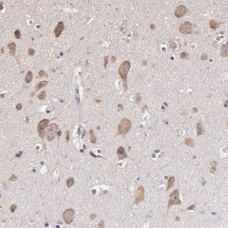 Atlas Antibodies Anti-OPHN1 Antibody