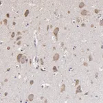 Atlas Antibodies Anti-OPHN1 Antibody