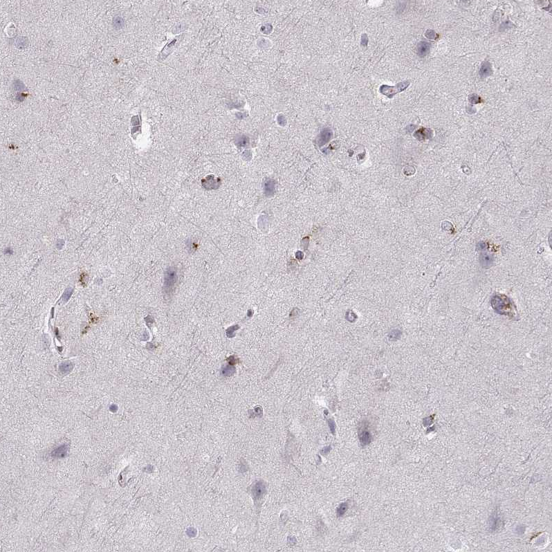 Atlas Antibodies Anti-OPRD1 Antibody
