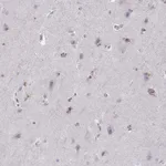 Atlas Antibodies Anti-OPRD1 Antibody