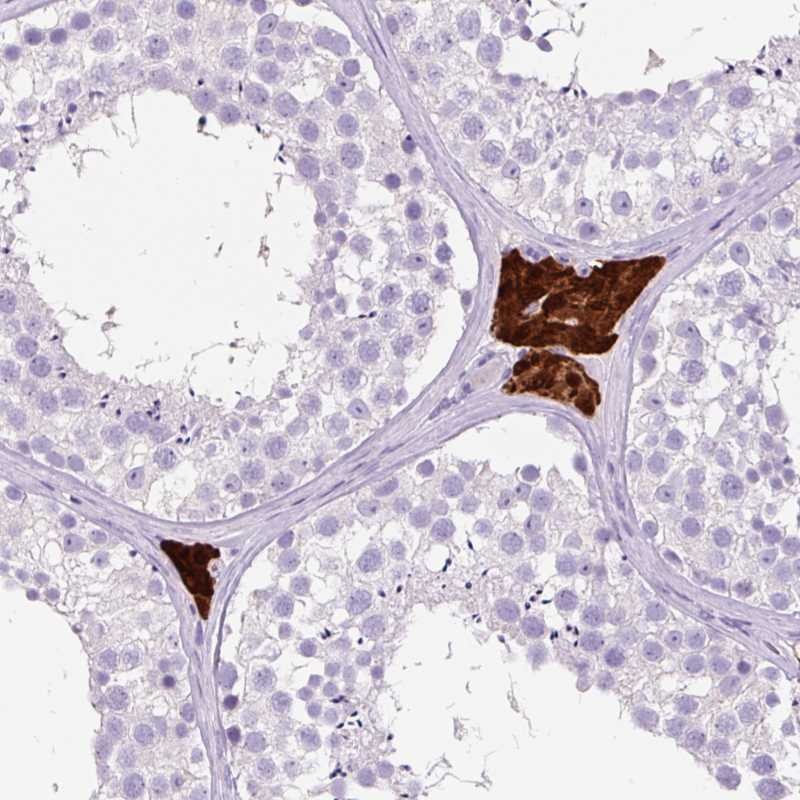 Atlas Antibodies Anti-OR10A7 Antibody