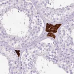 Atlas Antibodies Anti-OR10A7 Antibody