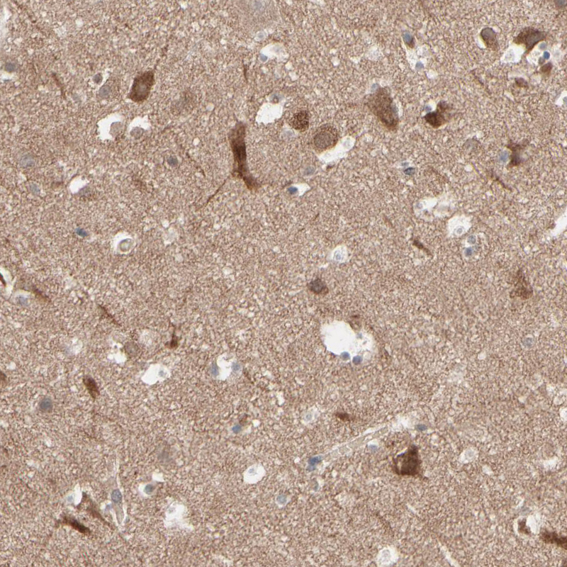 Atlas Antibodies Anti-OPTN Antibody