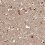 Atlas Antibodies Anti-OPTN Antibody
