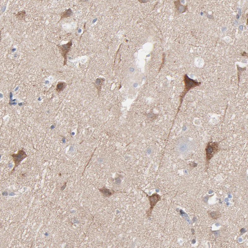 Atlas Antibodies Anti-OPTN Antibody