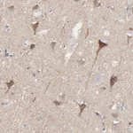 Atlas Antibodies Anti-OPTN Antibody
