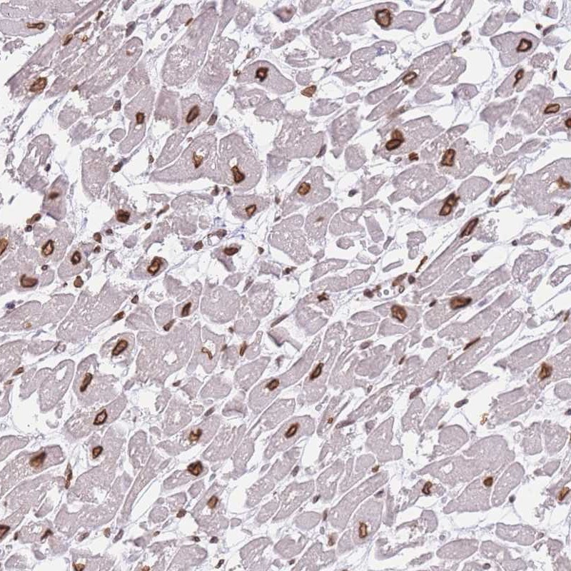 Atlas Antibodies Anti-OR10AD1 Antibody