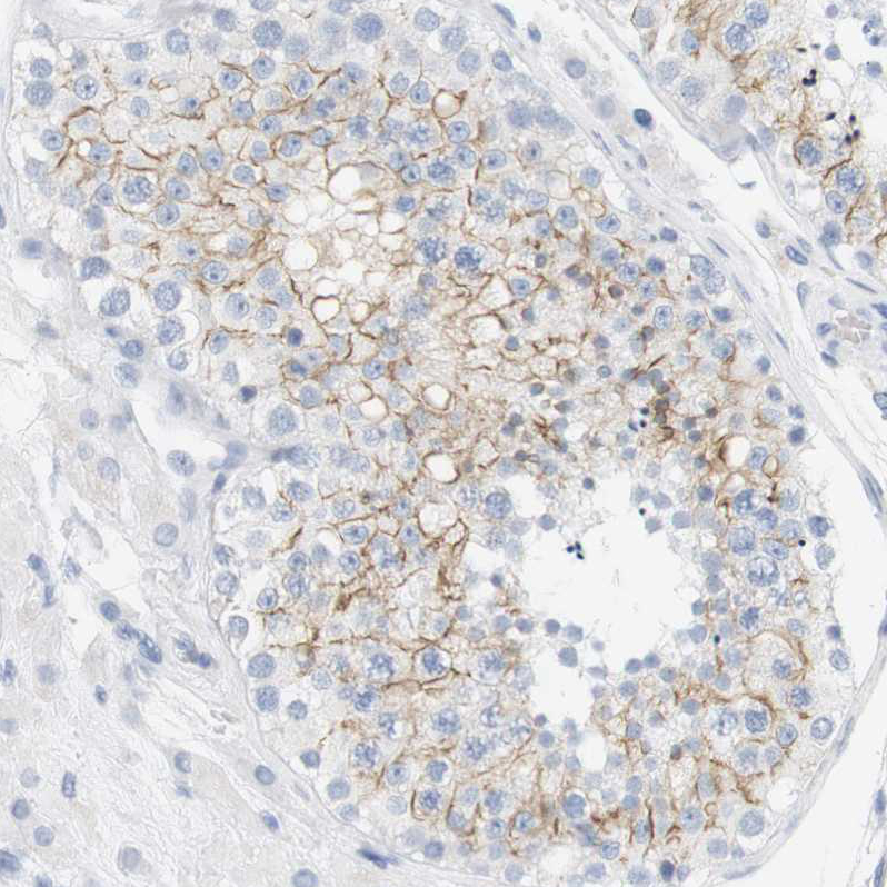 Atlas Antibodies Anti-OPRM1 Antibody