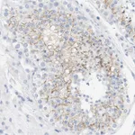 Atlas Antibodies Anti-OPRM1 Antibody