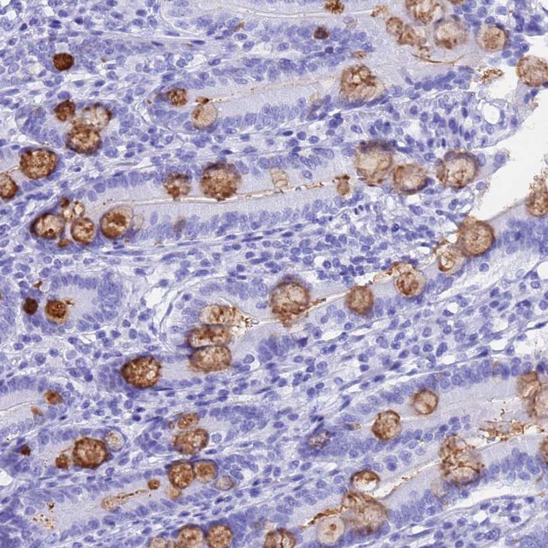 Atlas Antibodies Anti-OR10J3 Antibody