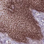 Atlas Antibodies Anti-OR10C1 Antibody