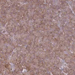 Atlas Antibodies Anti-OR10Q1 Antibody