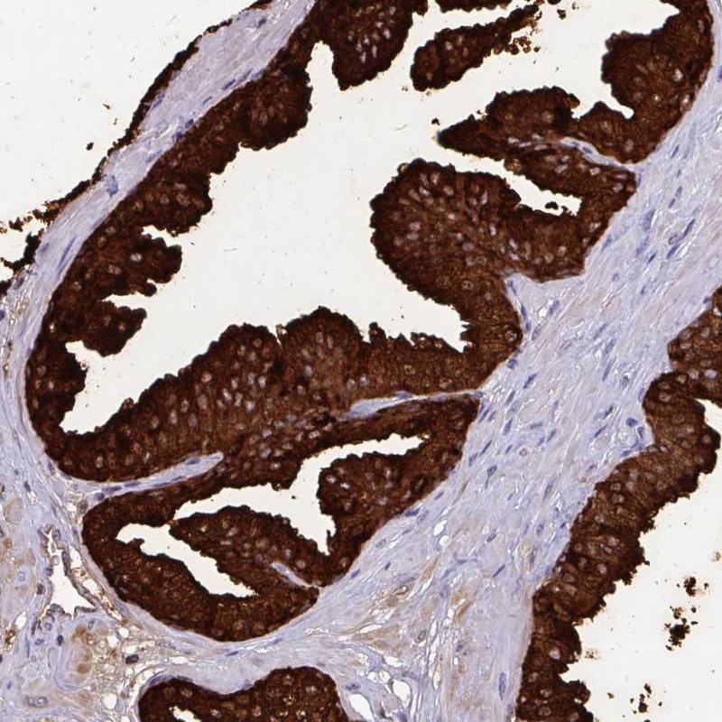 Atlas Antibodies Anti-OR10R2 Antibody
