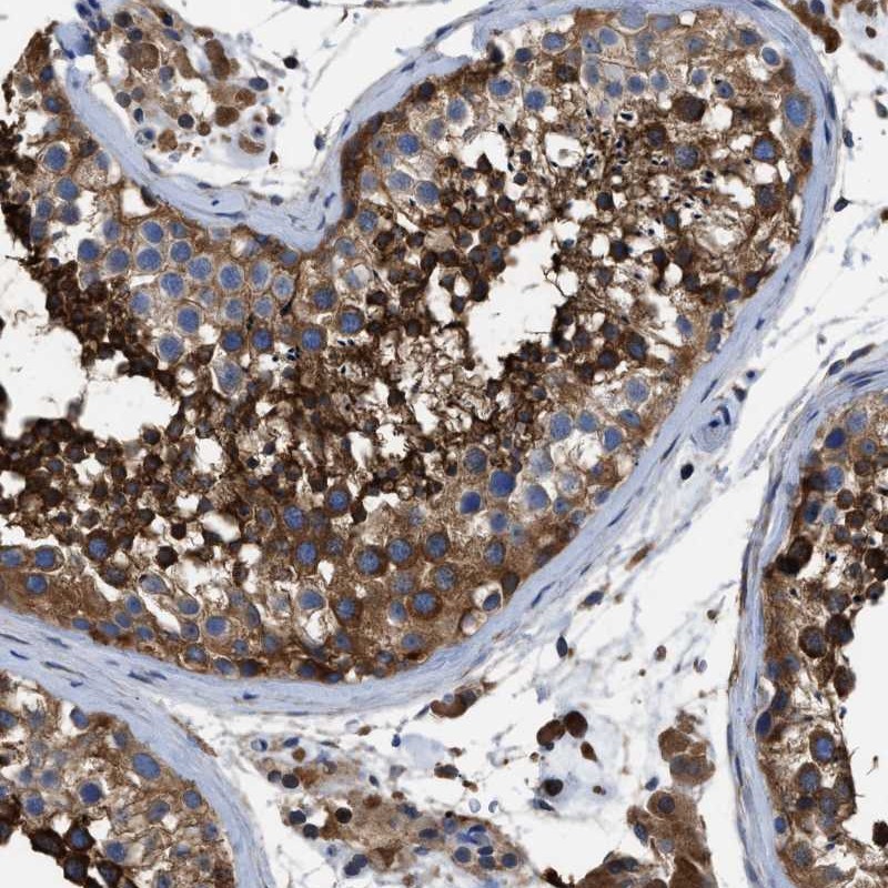 Atlas Antibodies Anti-OR10S1 Antibody