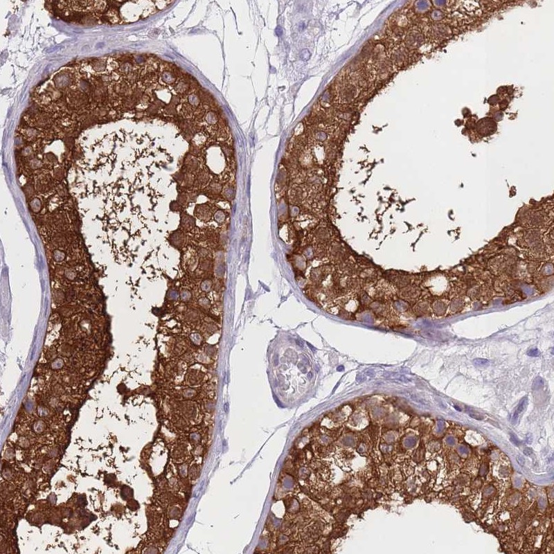 Atlas Antibodies Anti-OR11H1 Antibody