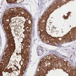 Atlas Antibodies Anti-OR11H1 Antibody