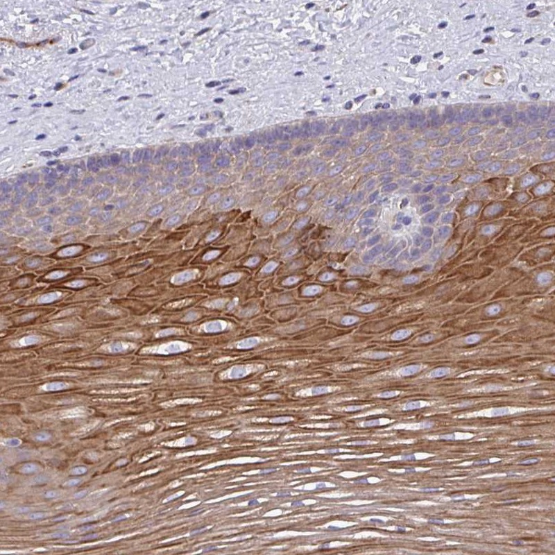Atlas Antibodies Anti-OR10Z1 Antibody