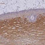 Atlas Antibodies Anti-OR10Z1 Antibody