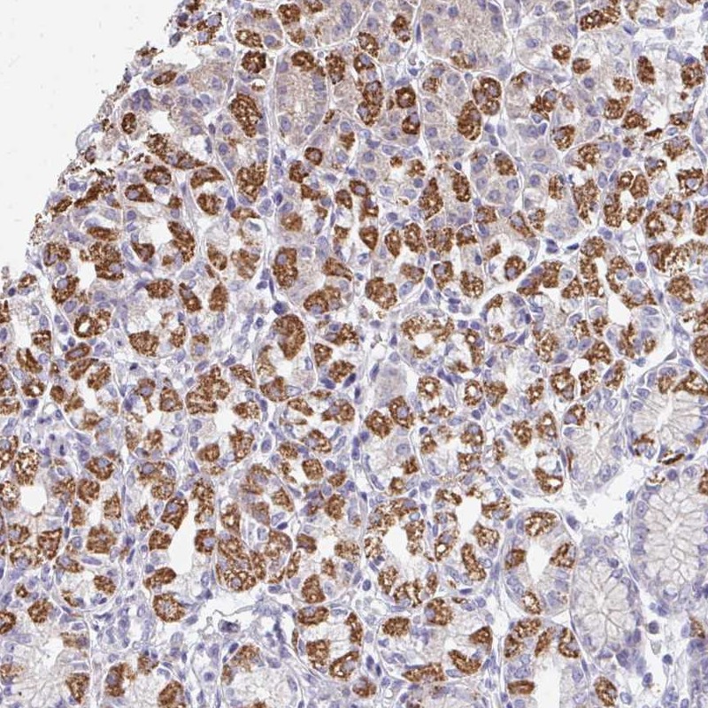 Atlas Antibodies Anti-OR10V1 Antibody