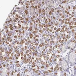 Atlas Antibodies Anti-OR10V1 Antibody