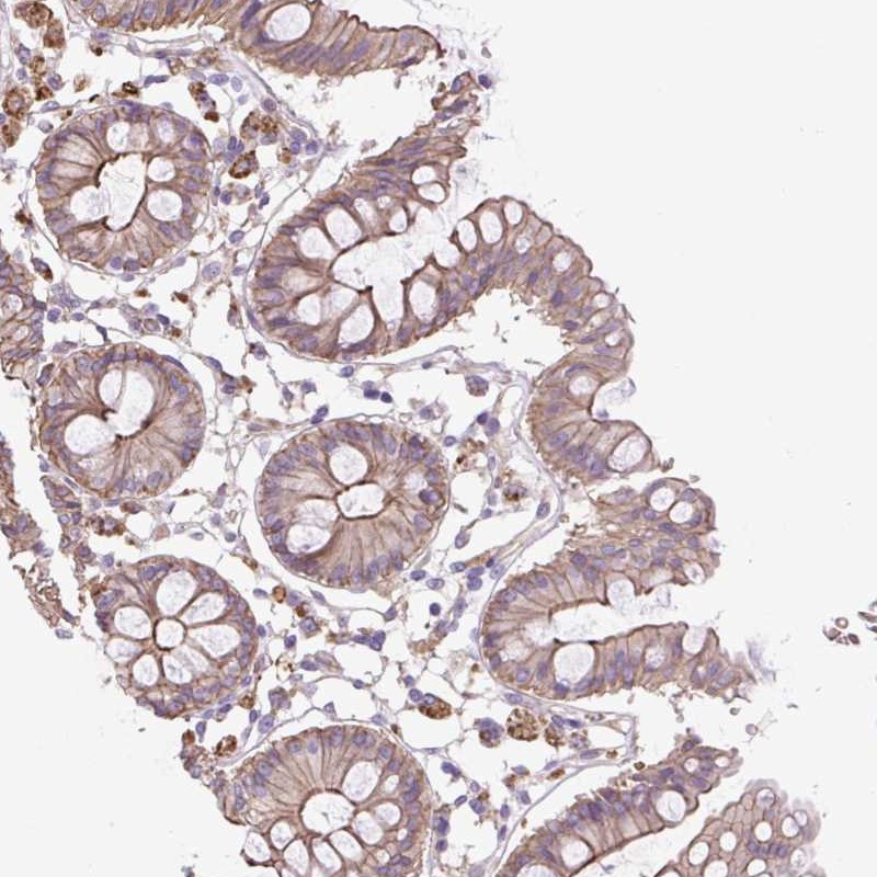 Atlas Antibodies Anti-OR13D1 Antibody