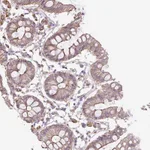 Atlas Antibodies Anti-OR13D1 Antibody