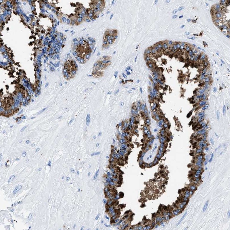 Atlas Antibodies Anti-OR14K1 Antibody