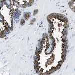 Atlas Antibodies Anti-OR14K1 Antibody