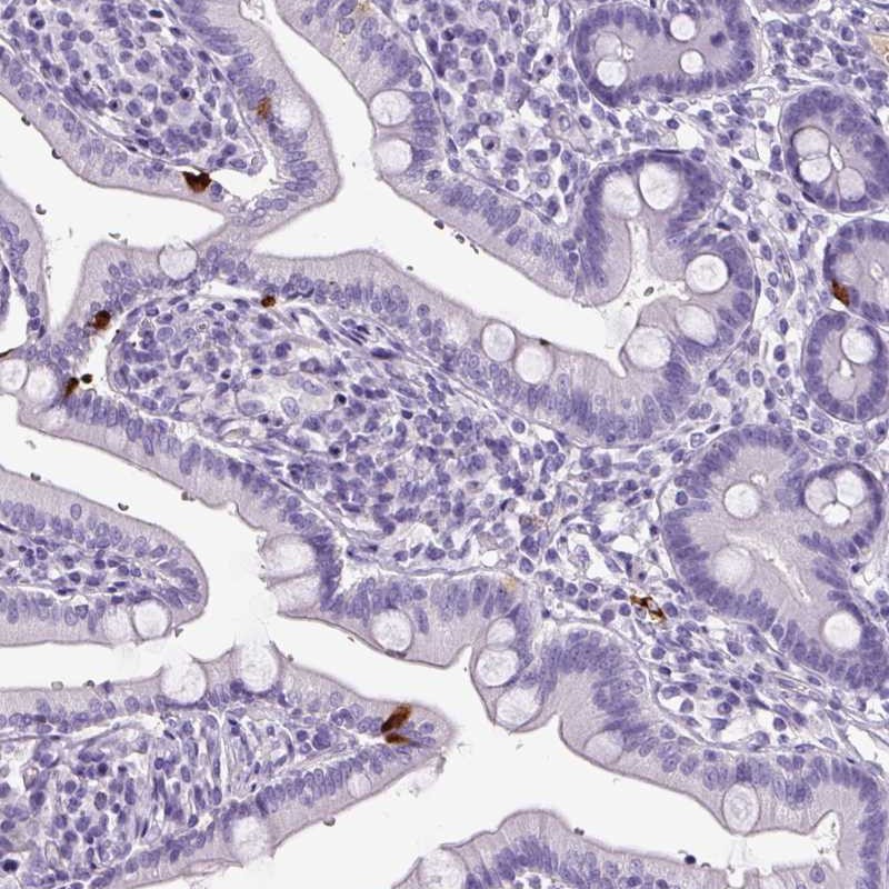 Atlas Antibodies Anti-OR14A2 Antibody
