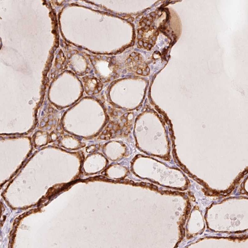 Atlas Antibodies Anti-OR13C3 Antibody