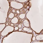 Atlas Antibodies Anti-OR13C3 Antibody