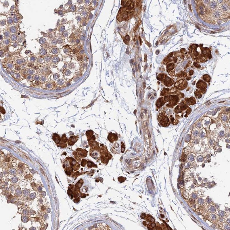 Atlas Antibodies Anti-OR14J1 Antibody
