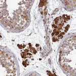Atlas Antibodies Anti-OR14J1 Antibody