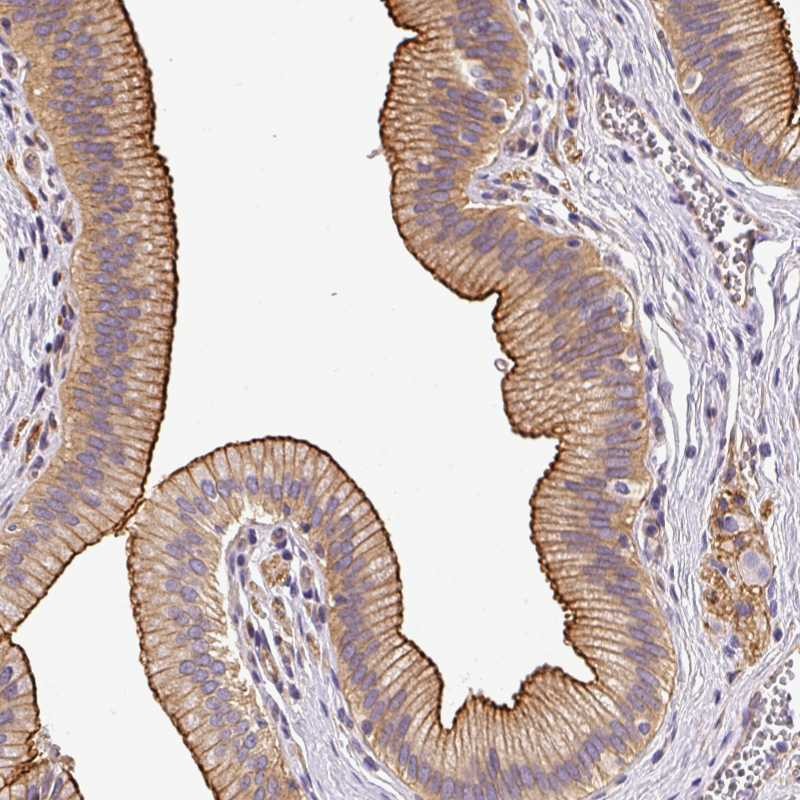 Atlas Antibodies Anti-OR11H4 Antibody