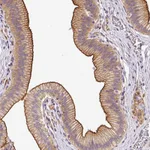 Atlas Antibodies Anti-OR11H4 Antibody
