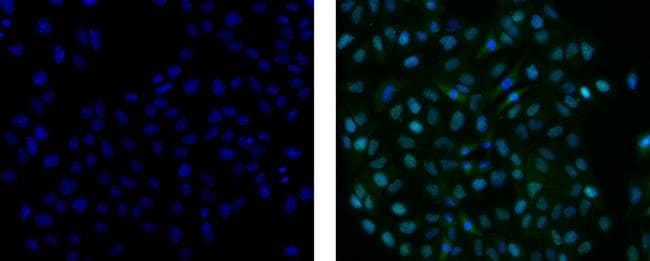 Thermo Fisher Scientific Rat anti-Mouse IgG2a Secondary Antibody, FITC, eBioscience