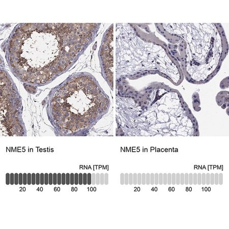 Merck Anti-NME5 antibody produced in rabbit