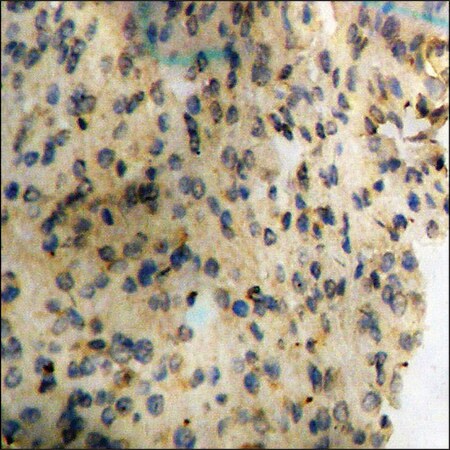 Merck Anti-phospho-Synuclein-alpha (pTyr133) antibody produced in rabbit