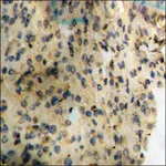 Merck Anti-phospho-Synuclein-alpha (pTyr133) antibody produced in rabbit