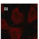 Merck Anti-Rab5 antibody, Mouse monoclonal