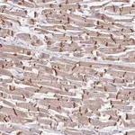 Merck Anti-JPH2 antibody produced in rabbit